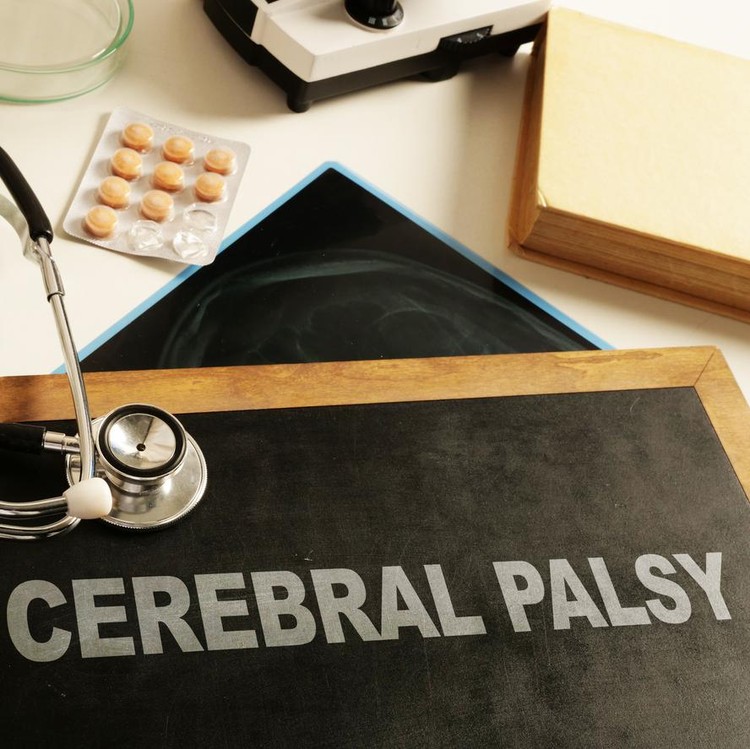 Ilustrasi Cerebral Palsy Ilustrasi Cerebral Palsy