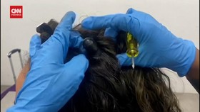 VIDEO: Modus Wanita Kolombia Selundupkan Kokain di Rambut