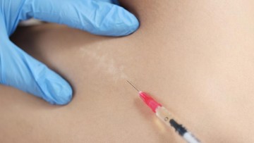 PROSEDUR SUNTIK KELOID YANG PERLU BUNDA TAHU