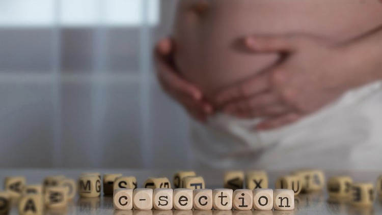 operasi caesar Bekas luka sayatan operasi caesar