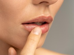 Bibir Kering Sampai Mengelupas usai Pakai Lipstik, Gimana Mengatasinya Dok?