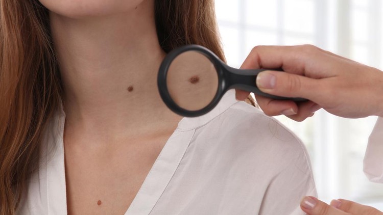 861010200 Doctor dermatologist examines birthmark of patient. Checking benign moles. Laser Skin tags removal
