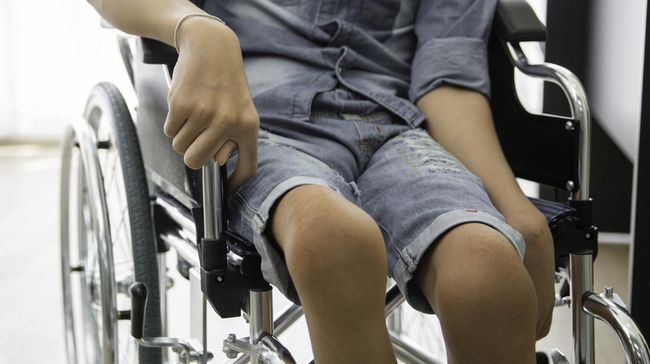 Kasus polio kembali merebak di Indonesia. Namun satu pertanyaan yang muncul, apakah polio bisa sembuh?
