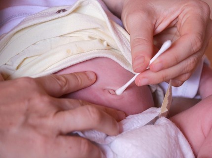 4 Cara Merawat Tali Pusar Bayi Baru Lahir, Jaga agar Tetap Kering Bun
