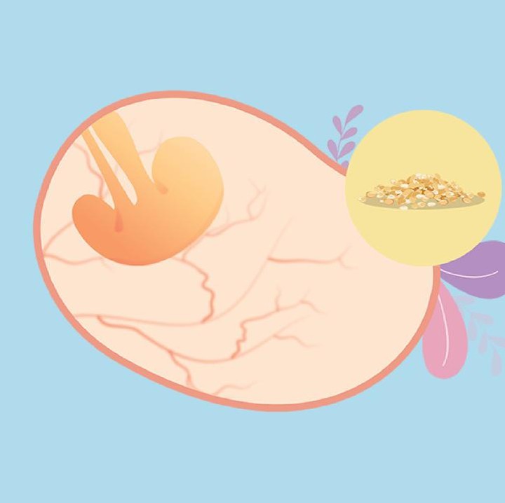 <p>Di usia 4 minggu, janin seukuran biji wijen atau berat 1 gr dan panjang 0.03 sampai 0,1 cm. Pada tahap ini, sel-sel terpisah menjadi tiga lapisan berbeda yang selanjutnya akan berkembang menjadi struktur tubuh. (Foto: HaiBunda)</p>