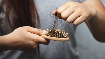 RAMBUT RONTOK HANYA BERSIFAT SEMENTARA