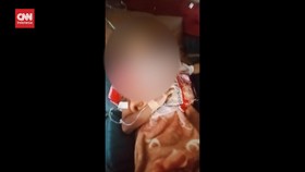 VIDEO: Siswa Kelas 2 SD Koma Dianiaya Kakak Kelas