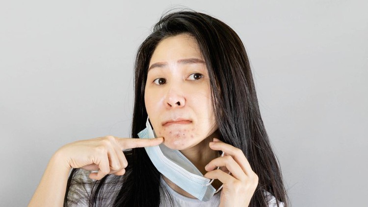 Young Asian woman wearing medical face mask and white t shirt point finger at pimple on chin. isolated on gray background,health care concept