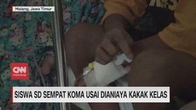 VIDEO: Siswa SD Sempat Koma Usai Dianiaya Kakak Kelas