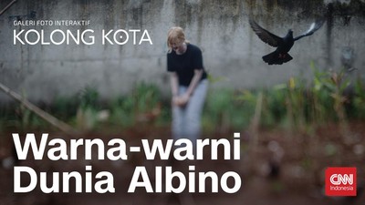 Kolong Kota: Warna-warni Dunia Albino