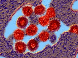 Virus Pertama di Dunia yang Ditemukan, Sudah Ada Miliaran Tahun