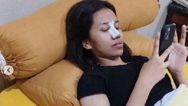 img-title Doddy Hapus Foto Mayang Usai Operasi Hidung, Ada Apa?