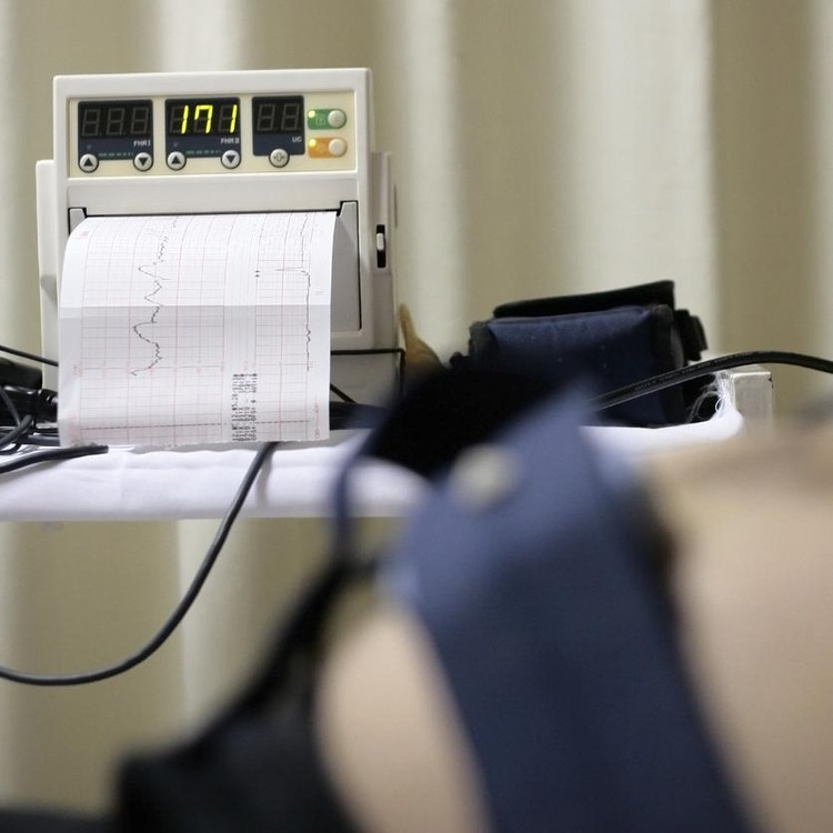 Cardiotocography atau CTG Cardiotocography atau CTG