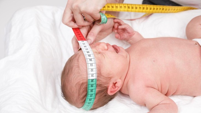 Lingkar kepala bayi
