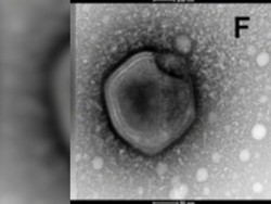 Ada Virus Zombie yang Dihidupkan Kembali Setelah 50.000 Tahun, Apakah Berbahaya?