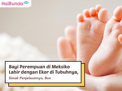 Bayi Perempuan di Meksiko Lahir dengan Ekor di Tubuhnya, Simak Penjelasannya, Bun