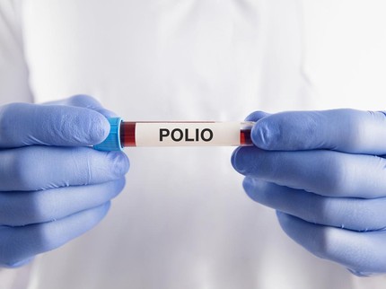 Kemenkes Buka Suara soal KLB Polio di Jateng dan Jatim, Sub Pin Polio Dimulai 15 Januari
