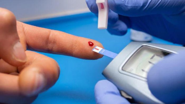 Hindari kolesterol dan asam urat/ foto: Freepik/ wirestock