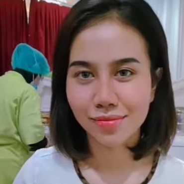 Wajah Mayang Usai Oplas Hidung Disebut Mirip Barbie Kumalasari