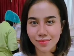 Wajah Mayang Usai Oplas Hidung Disebut Mirip Barbie Kumalasari