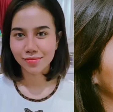 Ini 7 Potret Perubahan Hidung Baru Mayang Setelah Lepas Perban Operasi