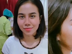 Ini 7 Potret Perubahan Hidung Baru Mayang Setelah Lepas Perban Operasi