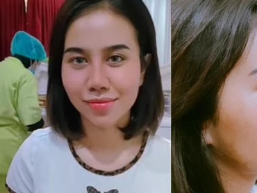 img-title Ini 7 Potret Perubahan Hidung Baru Mayang Setelah Lepas Perban Operasi