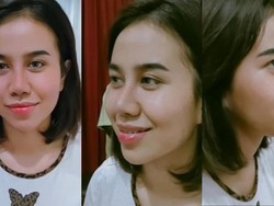 Tampilan Wajah Baru Mayang usai Operasi Hidung, Bikin Pangling?