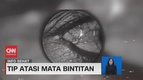 VIDEO: Atasi Hordeolum Atau Mata Bintitan