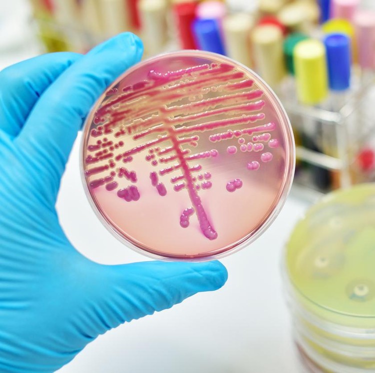 Bakteri E. Coli Bakteri E. Coli