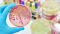 E .coli