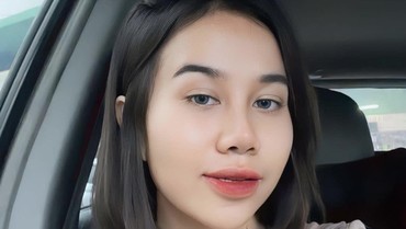 Dulu Dekil dan Jerawatan, Mayang Kini Pede Setelah Oplas