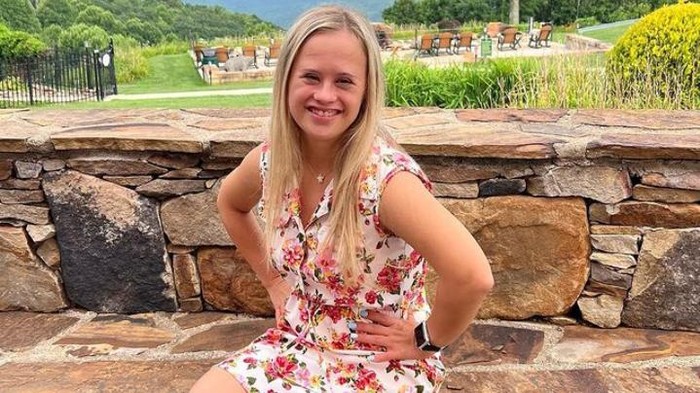 Sosok Inspiratif Abigail Adams, Penyandang Down Syndrome yang Memberdayakan Orang Lain Melalui Riasan