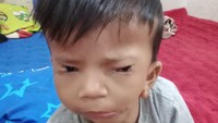 Puji Syukur, Afriliam Mulai Berjalan dan Berat Badannya Naik