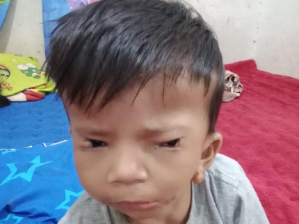 Puji Syukur, Afriliam Mulai Berjalan dan Berat Badannya Naik
