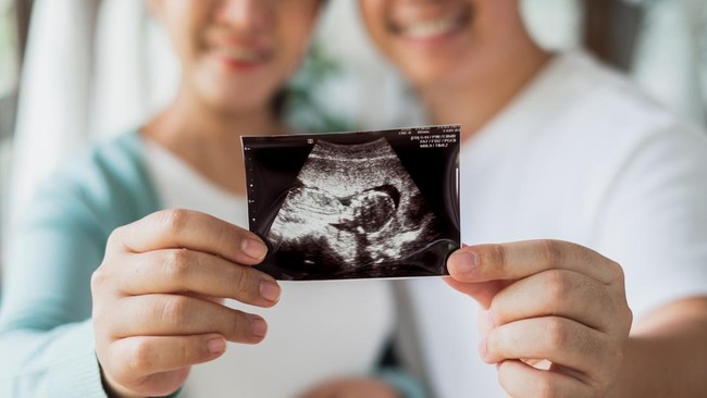 Tips Jitu Siapkan Dana Kelahiran Anak Pasutri Muda Dalam menyambut buah hati, pasutri muda sebaiknya menyiapkan tiga pos anggaran, mulai dari dana pra persalinan, biaya saat di RS, hingga setelah melahirkan.