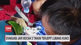 VIDEO: Evakuasi Jari Bocah 2 Tahun Terjepit Lubang Kunci