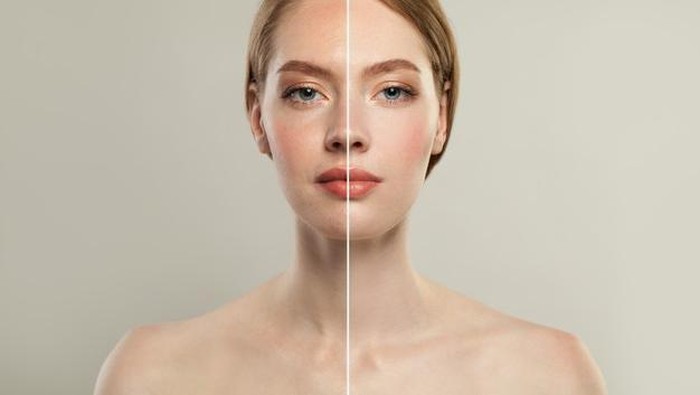 Ilustrasi kulit kusam /Foto: freepik.com