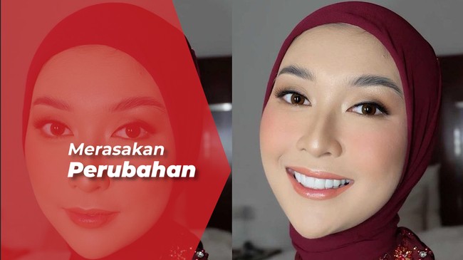Miss International Kevin Liliana Hijrah & Mantap Berhijab Sejak Pandemi