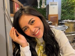 Rachel Vennya Operasi Mata, Sebut Muncul Kista usai Perawatan Kecantikan