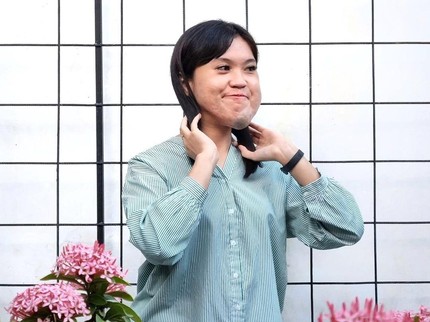 Kisah Chriselda Marito, Content Creator dengan Sakit Kelenjar Getah Bening Sejak Lahir