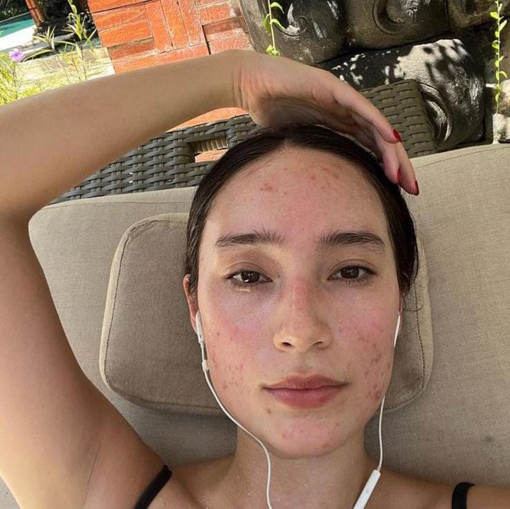 <p>Tak sedikit netizen mengomentari unggahan tersebut, bahkan ada yang sampai mengucapkan terima kasih, Bunda. "Foto slide kedua. <em>Thankyou mba tata to confidently show us on how to love your own skin and to embrace it</em>," tulis <em>@riotdejeaneiro.</em> (Foto: Instagram@tatjanasaphira)</p>