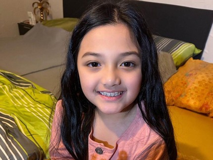 Potret Arsy Ultah Ke-8 Malah Tuai Pro dan Kontra Gara-gara Kawat Gigi