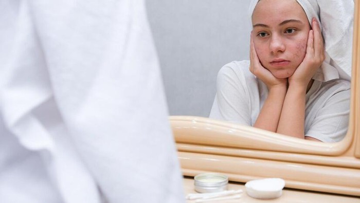 Mengenal Tanda hingga Cara Mengatasi Kulit Dehidrasi