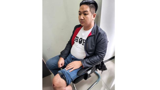 Businessman Agus Hartono allegedly tortured: head swollen and bleeding