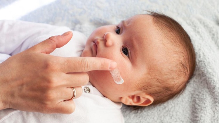 Ilustrasi Wewangian pada Skincare Bayi Baby with atopic dermatitis getting cream put. Care and Prevention Of Eczema. Keep Your Baby From Itching