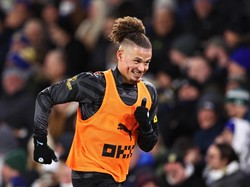 Habis Bilang Kegemukan, Guardiola Kini Sebut Kalvin Phillips Seksi Banget!
