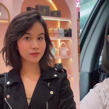 Makin Glowing, Intip 7 Potret Before-After Mayang Operasi Plastik