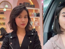 Makin Glowing, Intip 7 Potret Before-After Mayang Operasi Plastik