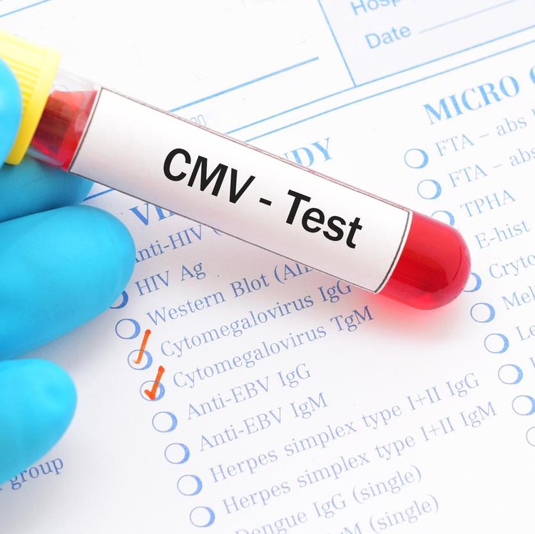 Ilustrasi Cytomegalovirus CMV Ilustrasi Cytomegalovirus CMV